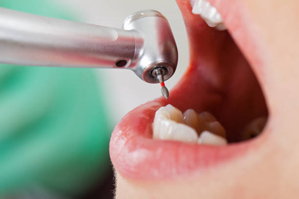 Best Pediatric Emergency Dentist in South Palm Beach, FL